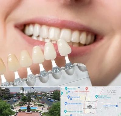مرکز کامپوزیت دندان در بهارستان