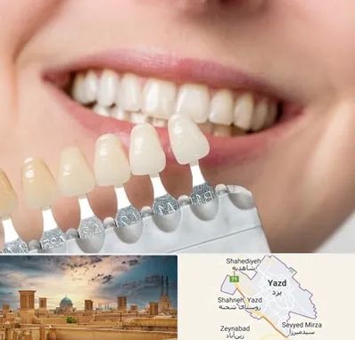 مرکز کامپوزیت دندان در یزد