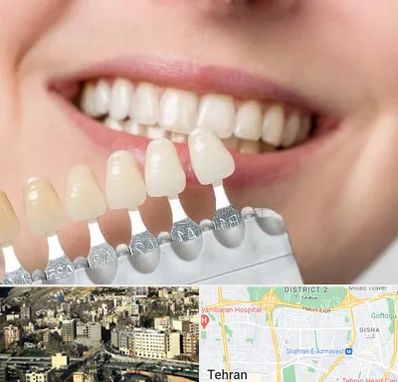 مرکز کامپوزیت دندان در مرزداران