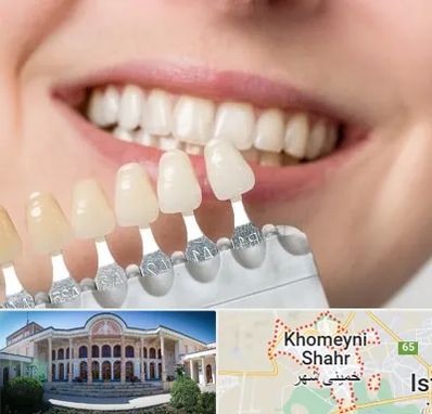 مرکز کامپوزیت دندان در خمینی شهر