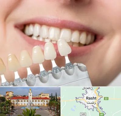 مرکز کامپوزیت دندان در رشت