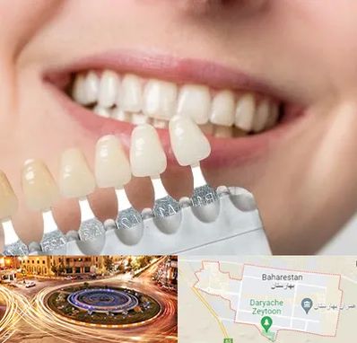 مرکز کامپوزیت دندان در بهارستان