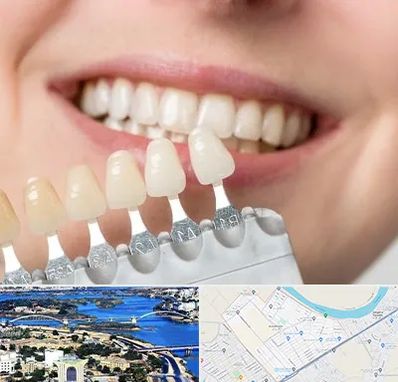 مرکز کامپوزیت دندان در کوروش اهواز