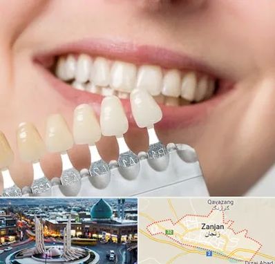 مرکز کامپوزیت دندان در زنجان