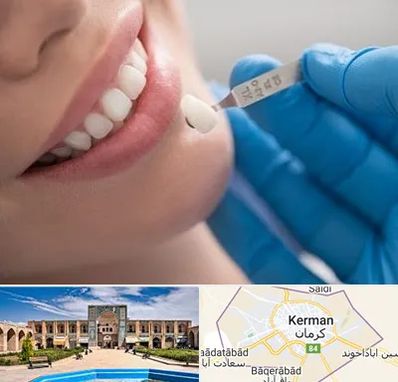 مرکز لمینت دندان در کرمان