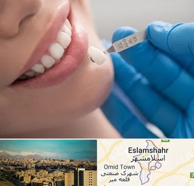 مرکز لمینت دندان در اسلامشهر