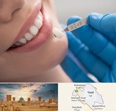 مرکز لمینت دندان در یزد