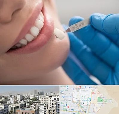 مرکز لمینت دندان در منطقه 14 تهران