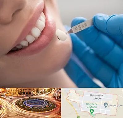 مرکز لمینت دندان در بهارستان