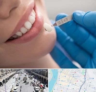 مرکز لمینت دندان در نادری اهواز