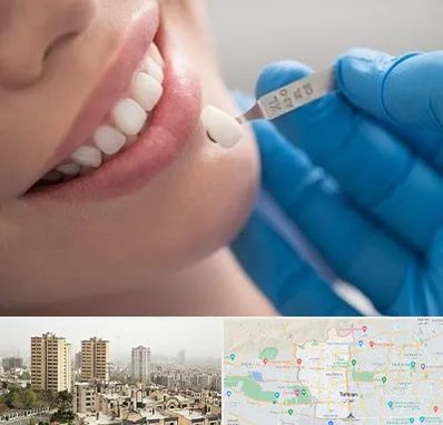 مرکز لمینت دندان در منطقه 5 تهران