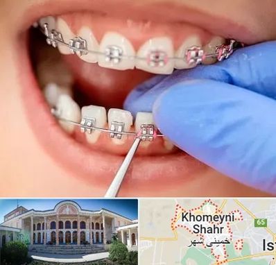 مرکز ارتودنسی دندان در خمینی شهر