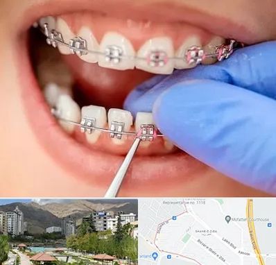 مرکز ارتودنسی دندان در شهر زیبا