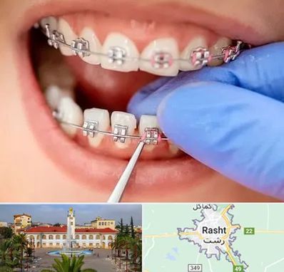 مرکز ارتودنسی دندان در رشت
