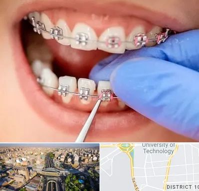 مرکز ارتودنسی دندان در استاد معین