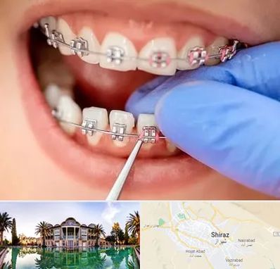 مرکز ارتودنسی دندان در شیراز