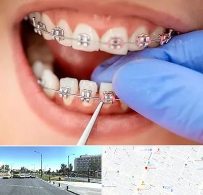 مرکز ارتودنسی دندان در بلوار کلاهدوز مشهد