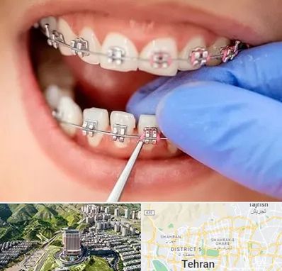 مرکز ارتودنسی دندان در شمال تهران