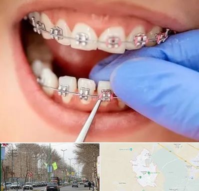 مرکز ارتودنسی دندان در نظرآباد کرج