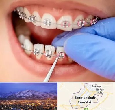 مرکز ارتودنسی دندان در کرمانشاه