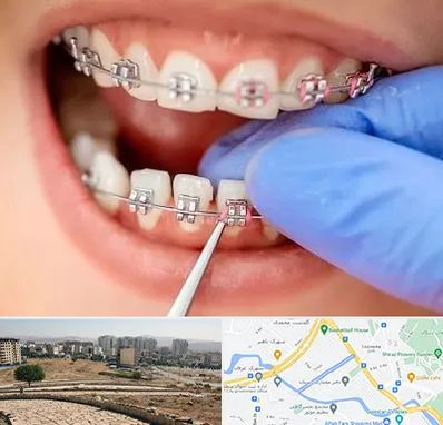 مرکز ارتودنسی دندان در کوی وحدت شیراز