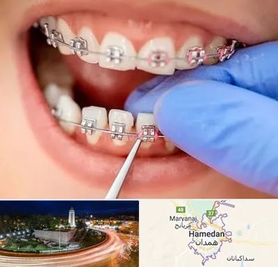 مرکز ارتودنسی دندان در همدان