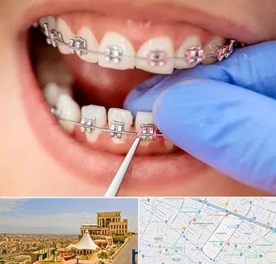 مرکز ارتودنسی دندان در هاشمیه مشهد