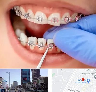 مرکز ارتودنسی دندان در چهارراه طالقانی کرج