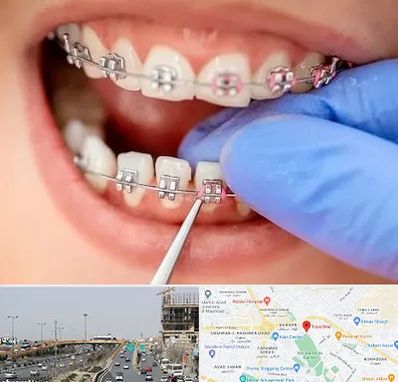 مرکز ارتودنسی دندان در بلوار توس مشهد