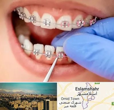 مرکز ارتودنسی دندان در اسلامشهر