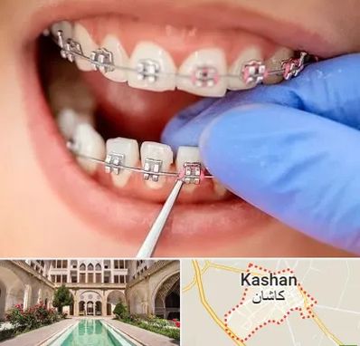 مرکز ارتودنسی دندان در کاشان