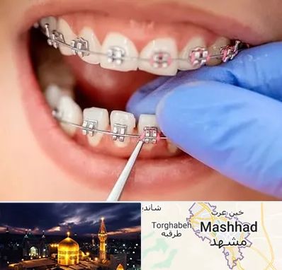 مرکز ارتودنسی دندان در مشهد