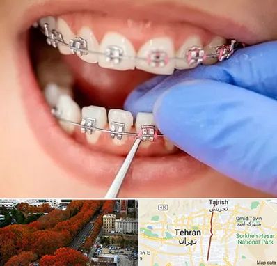 مرکز ارتودنسی دندان در ولیعصر