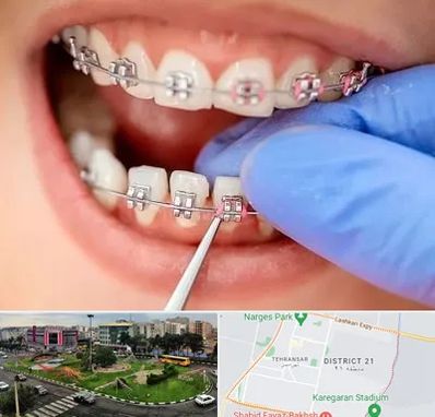 مرکز ارتودنسی دندان در تهرانسر