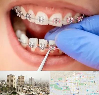 مرکز ارتودنسی دندان در منطقه 5 تهران