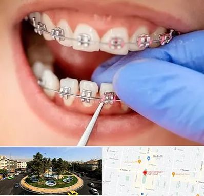 مرکز ارتودنسی دندان در هفت حوض