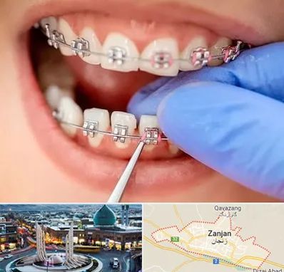 مرکز ارتودنسی دندان در زنجان