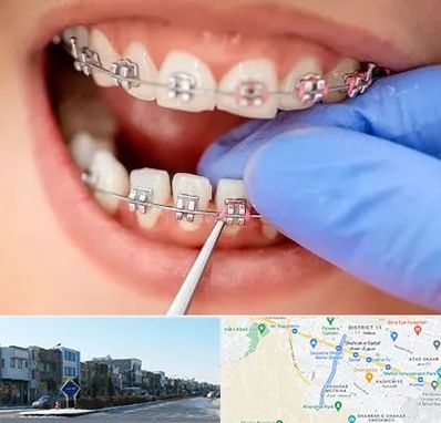 مرکز ارتودنسی دندان در شریعتی مشهد