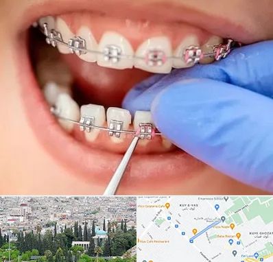 مرکز ارتودنسی دندان در محلاتی شیراز