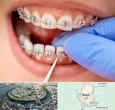 مرکز ارتودنسی دندان در بابل