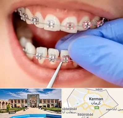 مرکز ارتودنسی دندان در کرمان