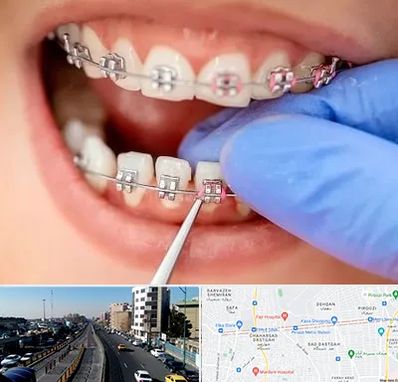 مرکز ارتودنسی دندان در پیروزی