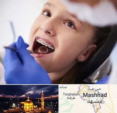 دکتر ارتودنسی کودکان در مشهد