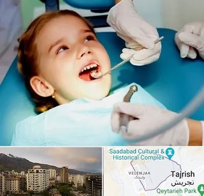 دندانپزشکی اطفال در زعفرانیه