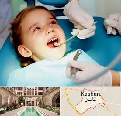 دندانپزشکی اطفال در کاشان