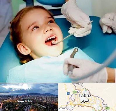 دندانپزشکی اطفال در تبریز