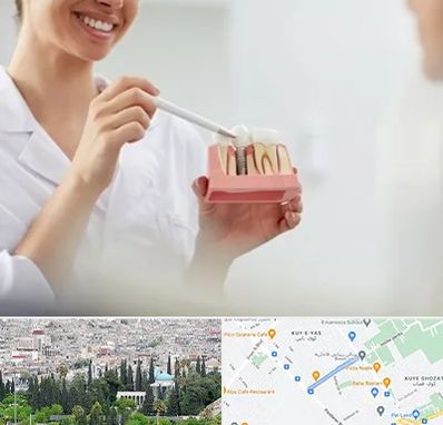 دکتر دندانساز در محلاتی شیراز