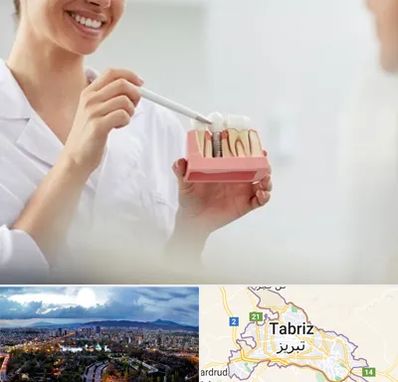 دکتر دندانساز در تبریز