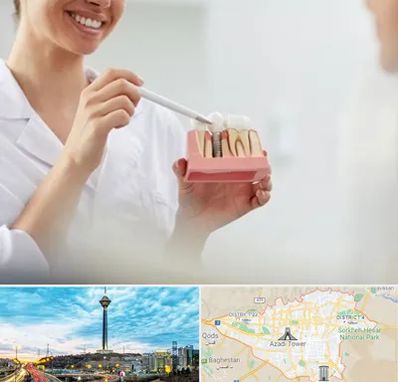 دکتر دندانساز در تهران