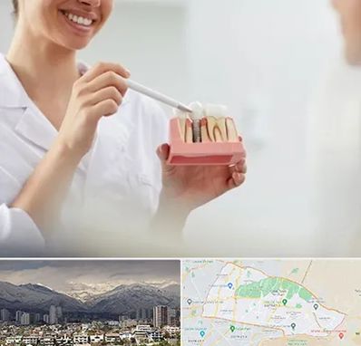 دکتر دندانساز در منطقه 4 تهران 